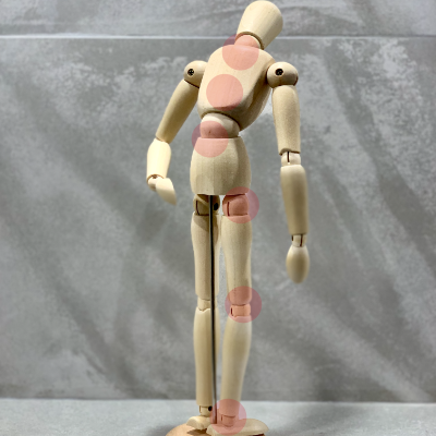 arthrose sur toutes les articulations portantes