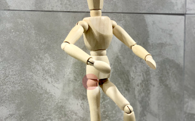 Coxarthrose de la Hanche : Causes, Symptômes et Traitements